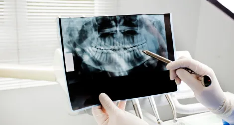 Dental Digital X-rays At Pediatric