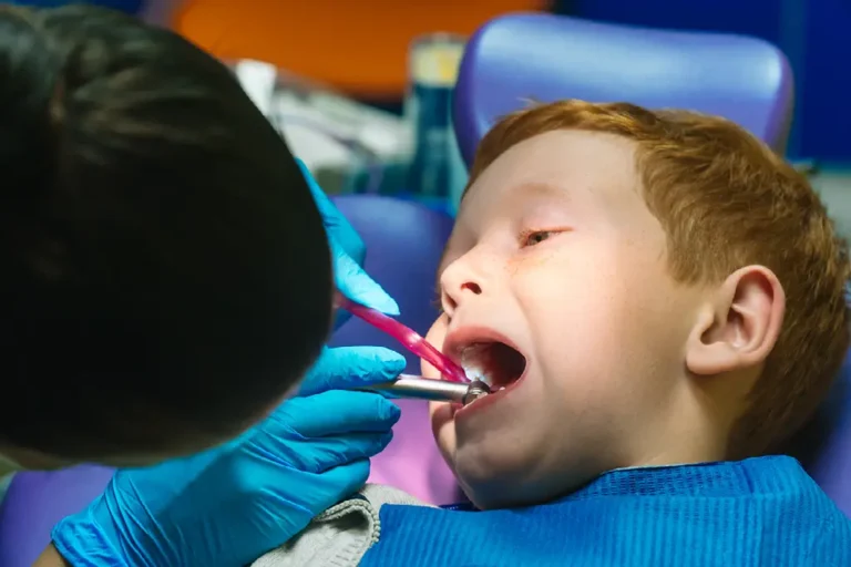 Importance of Silver Diamine Fluoride
