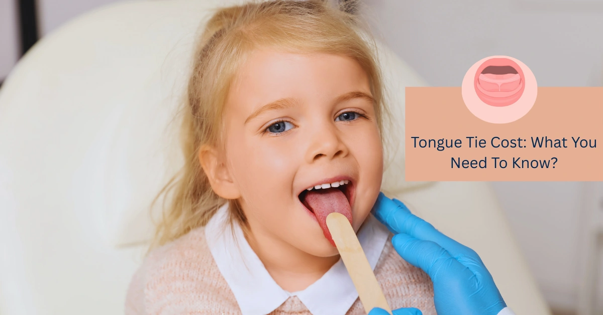 Tongue Tie Cost What You Need To Know 2