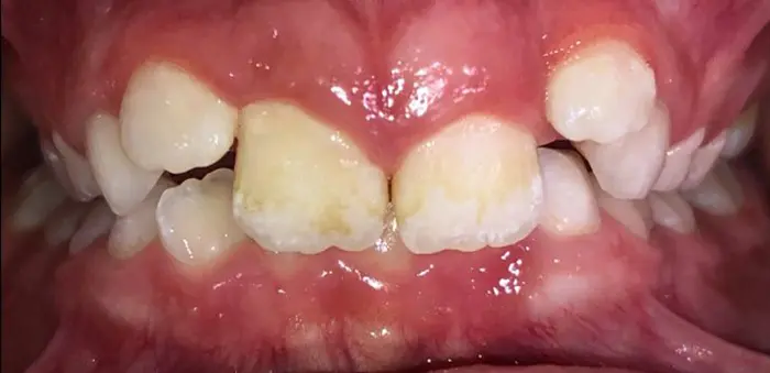 img Actual Patient Casen before 1