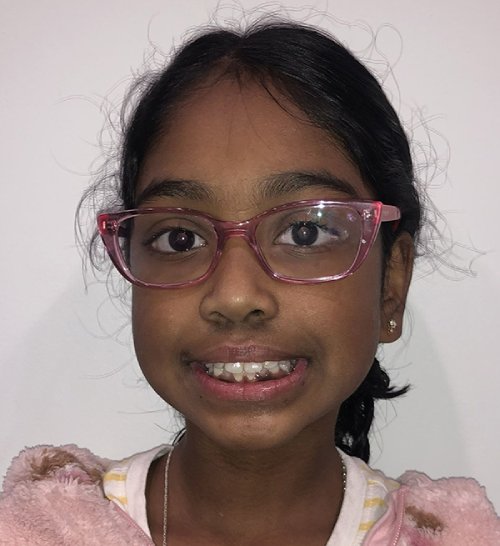 img Akshaya Before 1