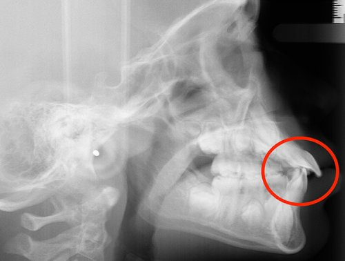 img Akshaya Before 2