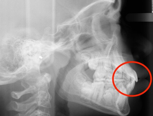 img Akshaya after 2 1