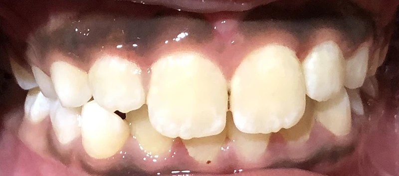 img Arjun before 1 1