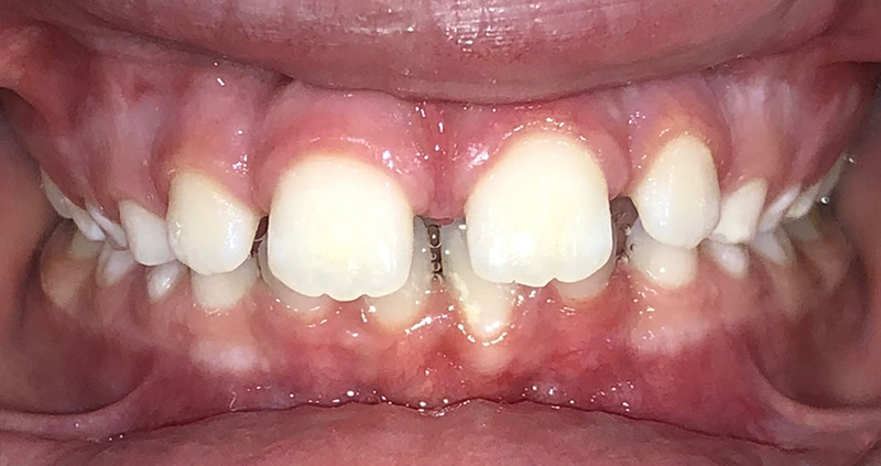 img Ellanor before before 1