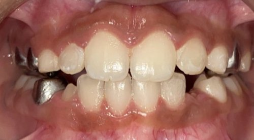 img Nusaybah After 2