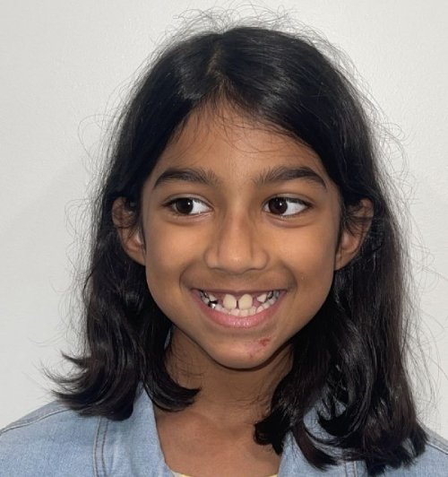 img Nusaybah Before 1