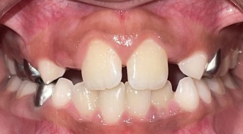 img Nusaybah before 2