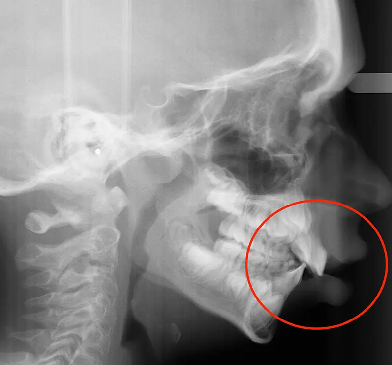 img Samuel before2 1