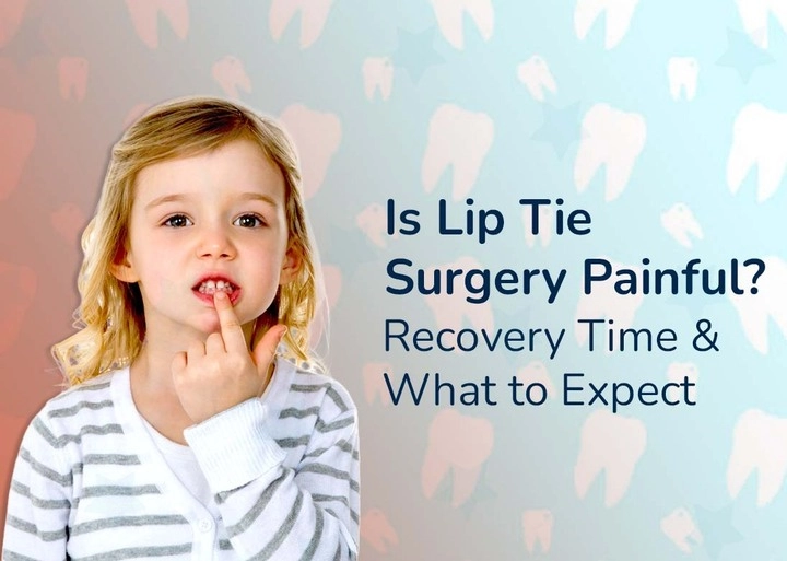 is_lip_tie_surgery_painful_recovery_time___what_to_expect_720