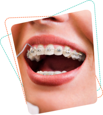 Adult braces treatment at orthodontist