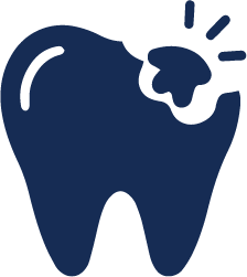 Cavities & Tooth Decay​