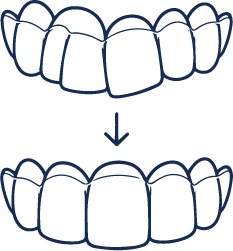 Comfortable Smile Improvement