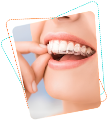 Adult using Invisalign aligners
