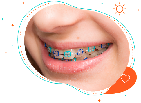 Child braces smile at kids orthodontist in Corinth, TX