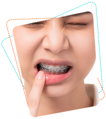 Child experiencing orthodontic emergency