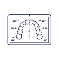 Personalized Aligner Planning​