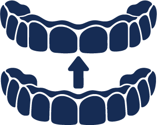 Removable Aligners​