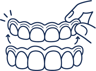 Removable Orthodontic Solution​