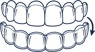 Removable Orthodontic Solution​