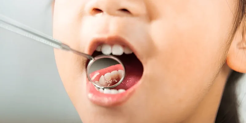 Additional Procedures​